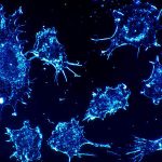 Wer an bestimmten Krebsarten erkrankt hat Pech gehabt