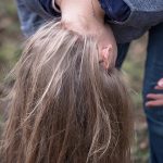 Kopfhautjucken – wie man den Juckreiz besiegt