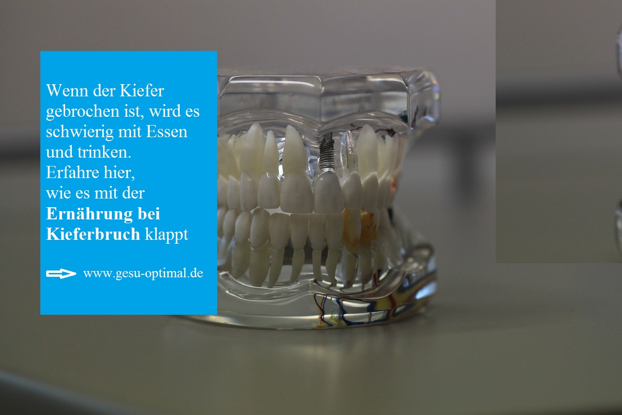 Kieferbruch – wie am besten Essen und Trinken-