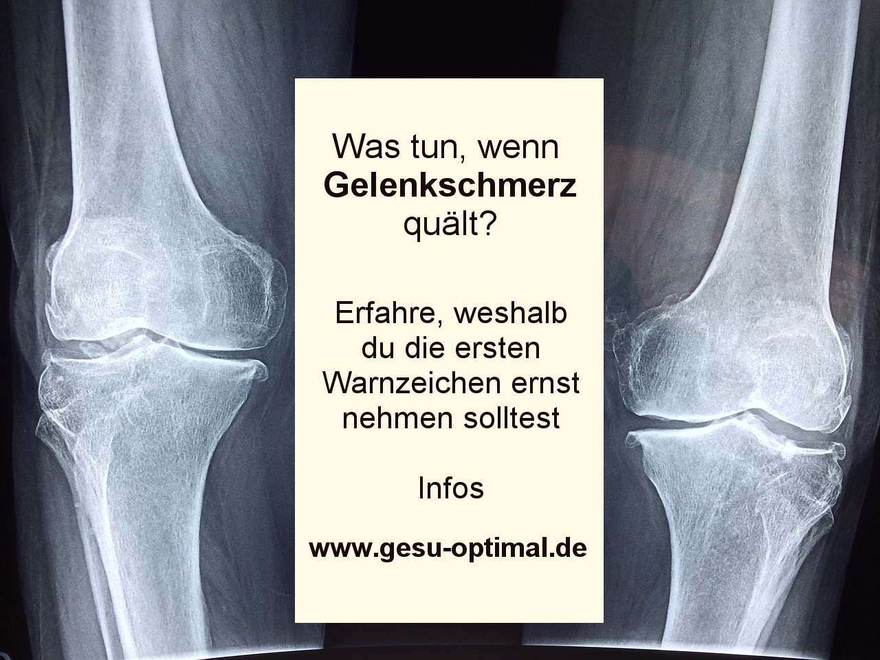 Wenn Gelenkschmerz die Lebensqualität einschränkt