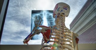 Bei Schmerzen im Ruecken – Orthopaedie oder Osteologie