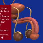 Zystitis beim Mann – unangenehm und schmerzhaft-