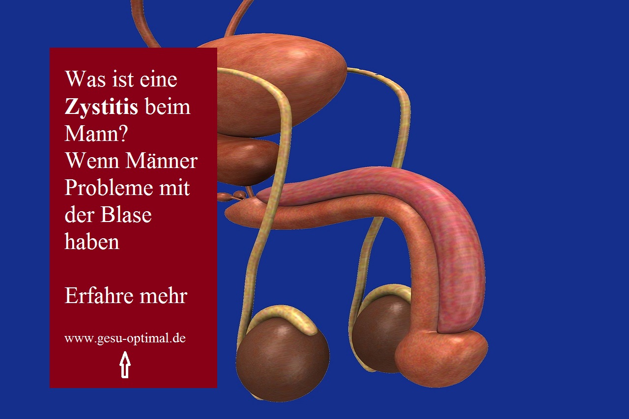 Zystitis beim Mann – unangenehm und schmerzhaft-
