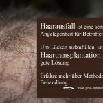 Haarausfall – Haartransplantation füllt die Lücken