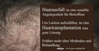 Haarausfall – Haartransplantation füllt die Lücken