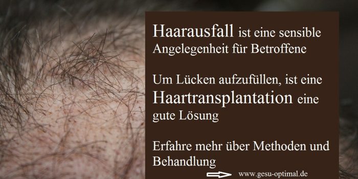 Haarausfall – Haartransplantation füllt die Lücken