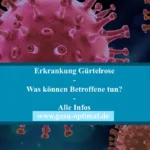 Erkrankung Gürtelrose – Anzeichen und Behandlung.-jpg