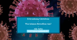 Erkrankung Gürtelrose – Anzeichen und Behandlung.-jpg