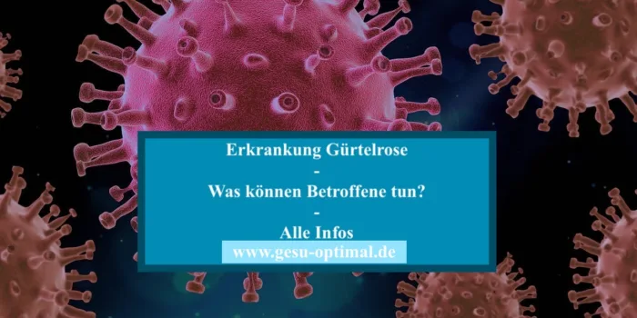 Erkrankung Gürtelrose – Anzeichen und Behandlung.-jpg