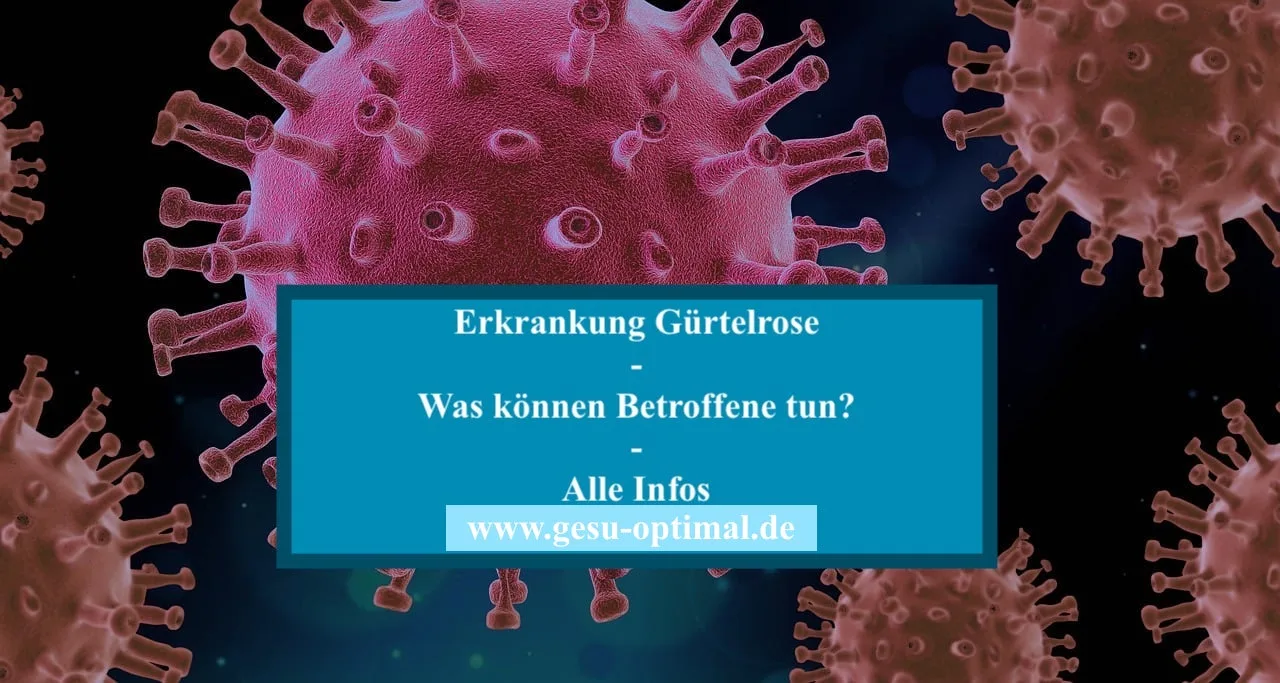 Erkrankung Gürtelrose – Anzeichen und Behandlung.-jpg